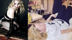 Madonna tedavisini sosyal medyadan paylaştı